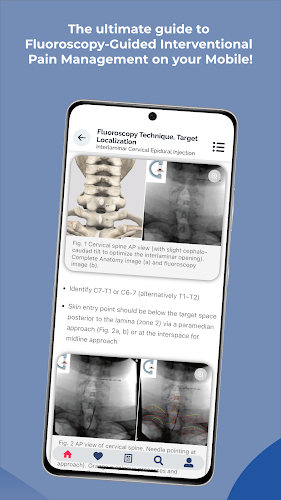 Interventional Pain App Screenshot 3