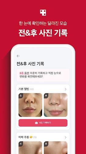 에이지알 - 메디큐브 디지털클리닉 AGE-R ဖန်သားပြင်ဓာတ်ပုံ 2